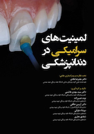 لمینیت های سرامیکی در دندانپزشکی